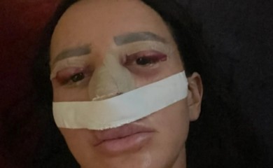 Od mačijih očiju do filera: Slađa Poršelina ne prestaje s promjenama