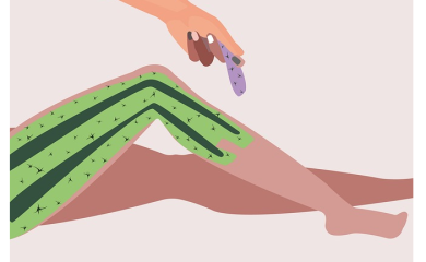 Sve za manji bol: Greške koje se čine prilikom depilacije voskom kod kuće