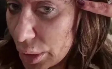 ANA NIKOLIĆ BRUTALNO PRETUČENA! Šok snimak pjevačice u ranama, pokazala jezive povrede