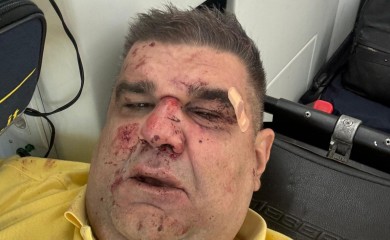 POKUŠAJ UBISTVA SAŠE MIRKOVIĆA! Brutalno pretučen u Zagrebu