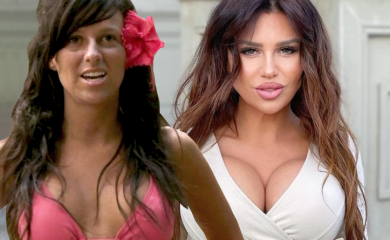 GDJE SU GRUDI? Ovako je STANIJA IZGLEDALA PRIJE OPERACIJA