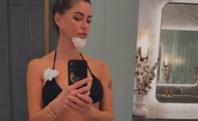 Dijana Diline doživjela nezgodu na skuteru: „Vilica polomljena, brada ušivena“