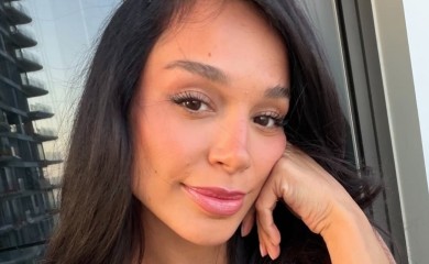 Edita o estetskim korekcijama: Sreća, pa imam para jer nisam ni na šta ličila