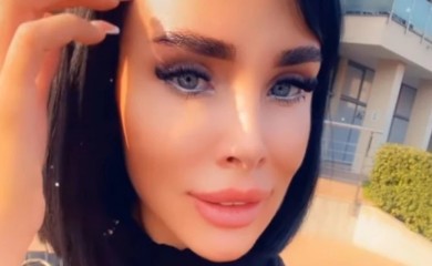 OTIŠLA NA REMONT! Lice Aleksandre Subotić je sada DRUGAČIJE, evo kako izgleda nakon TRETMANA