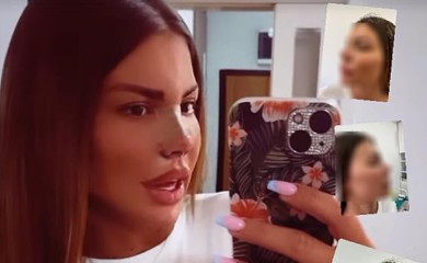 SJEKLI SU MI REBRO JER VIŠE NISAM IMALA HRSKAVICU! Dragana Mitar otrkrila jezive detalje SEDME OPERACIJE NOSA, spomenula i Edisa