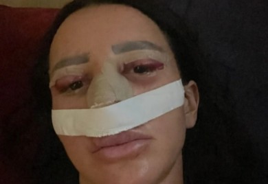 Od mačijih očiju do filera: Slađa Poršelina ne prestaje s promjenama