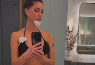Dijana Diline doživjela nezgodu na skuteru: „Vilica polomljena, brada ušivena“