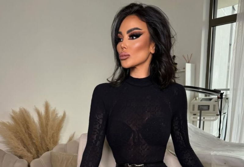 Starleta u epizodi sa novim estetskim zahvatima: Tamara Đurić želi da promijeni krv, osvježi zadnjicu i grudi