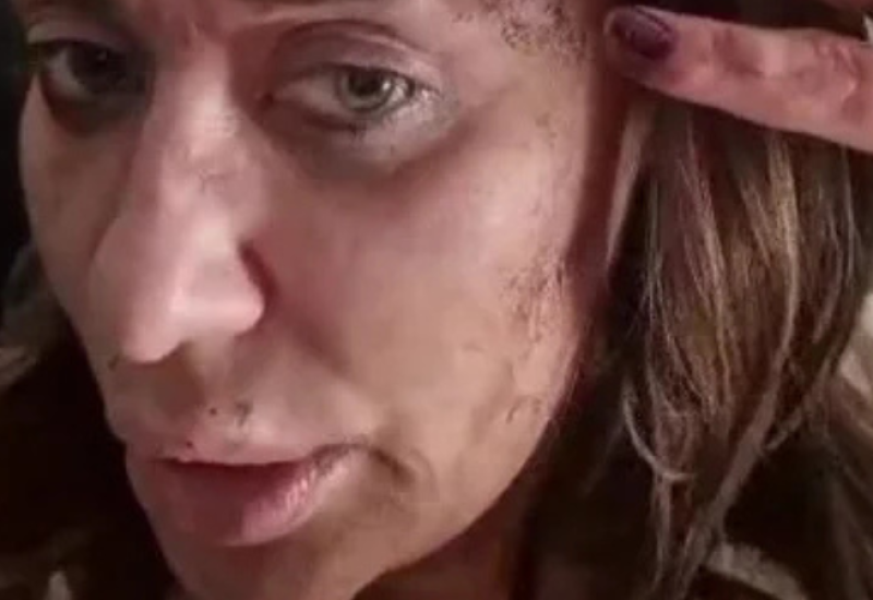 ANA NIKOLIĆ BRUTALNO PRETUČENA! Šok snimak pjevačice u ranama, pokazala jezive povrede