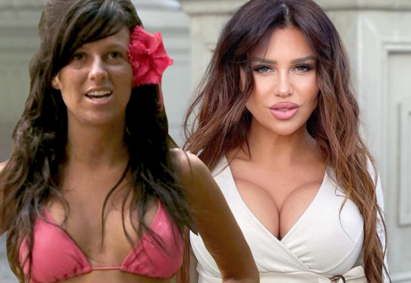 GDJE SU GRUDI? Ovako je STANIJA IZGLEDALA PRIJE OPERACIJA