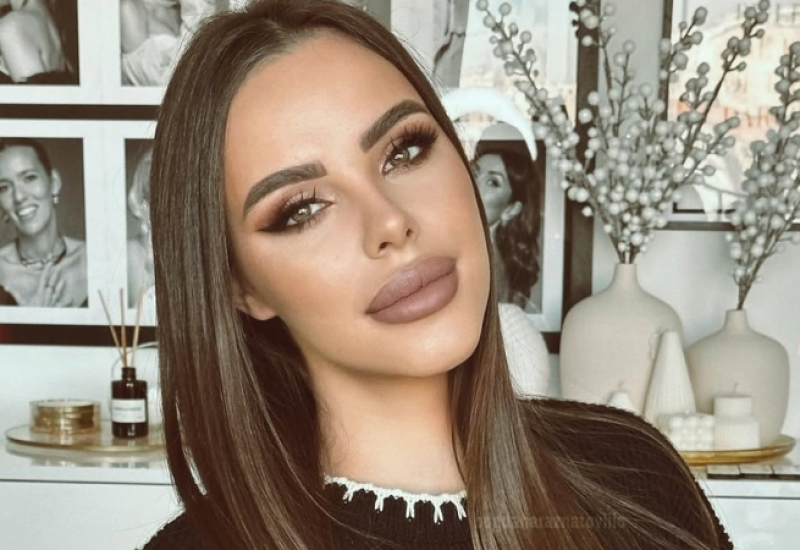 BOGDANA RAŽNATOVIĆ SMANJILA USNE! Cecina snajka se vratila prirodnijem izgledu