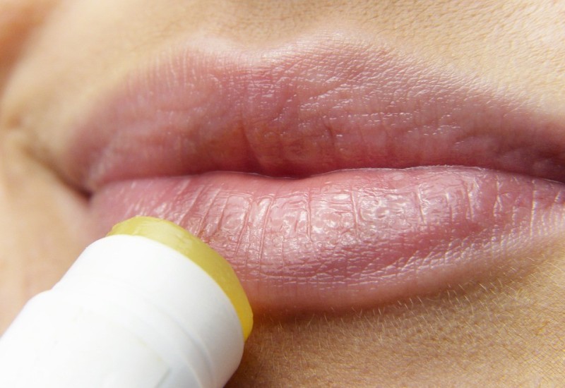 OTKRIVAMO: Zašto se herpes uvijek vraća?