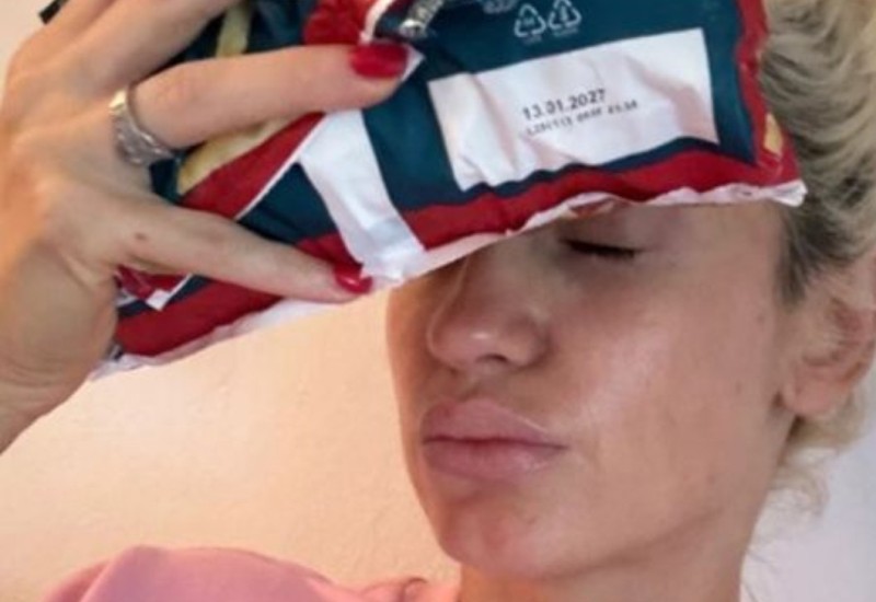 Anja Mit razbila glavu: Na čelu drži kesu punu leda, otkrila šta joj se dogodilo